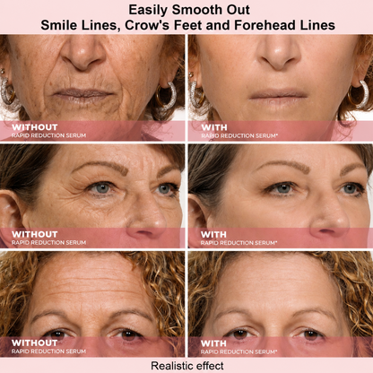 Results in 60 Seconds - Lunivéa Rapid Wrinkle-Reducing Serum for Wrinkles, Bags & Dark Circles