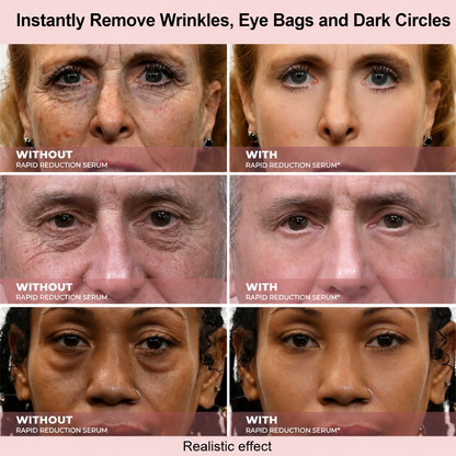 Results in 60 Seconds - Lunivéa Rapid Wrinkle-Reducing Serum for Wrinkles, Bags & Dark Circles
