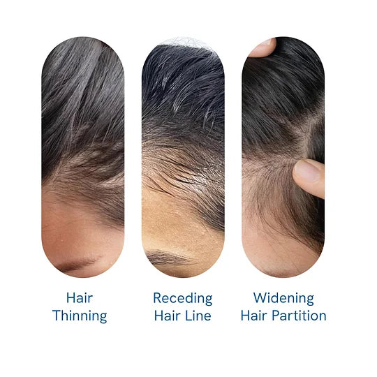 ✨Hair Growth Serum Roll-On (New Formula)🎁