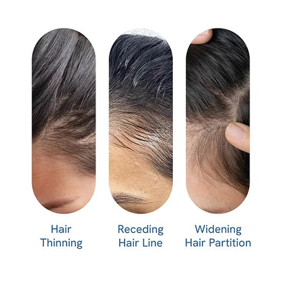 ✨Hair Growth Serum Roll-On (New Formula)🎁