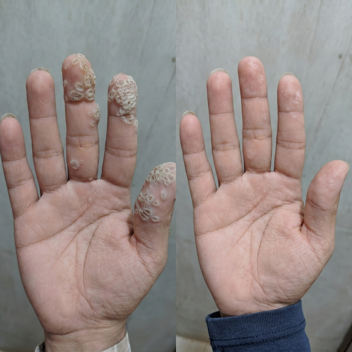 Customer story about hand application