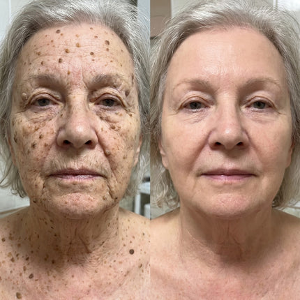 Customer story about a gentle, controlled routine