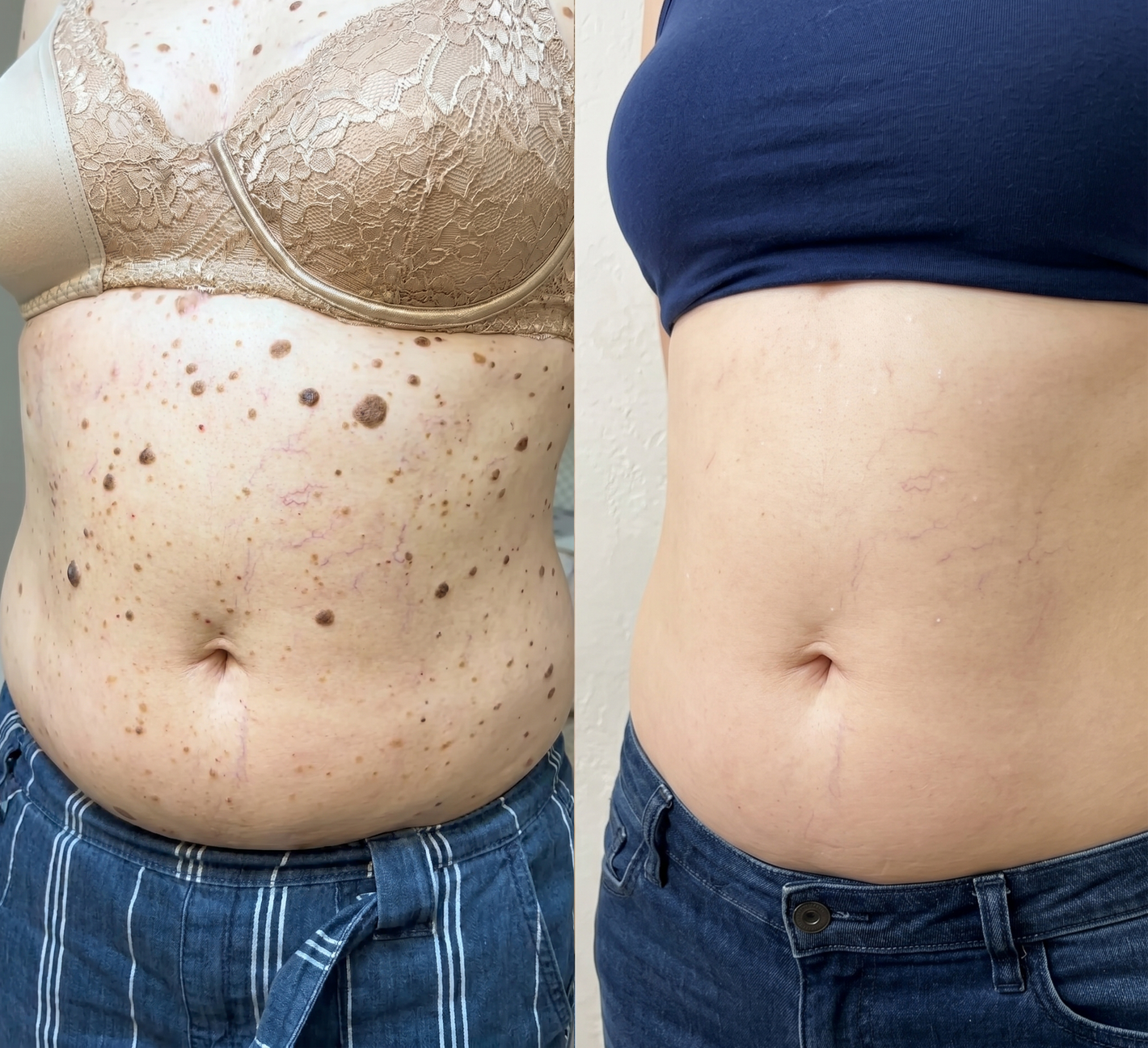 Customer story about body-area application