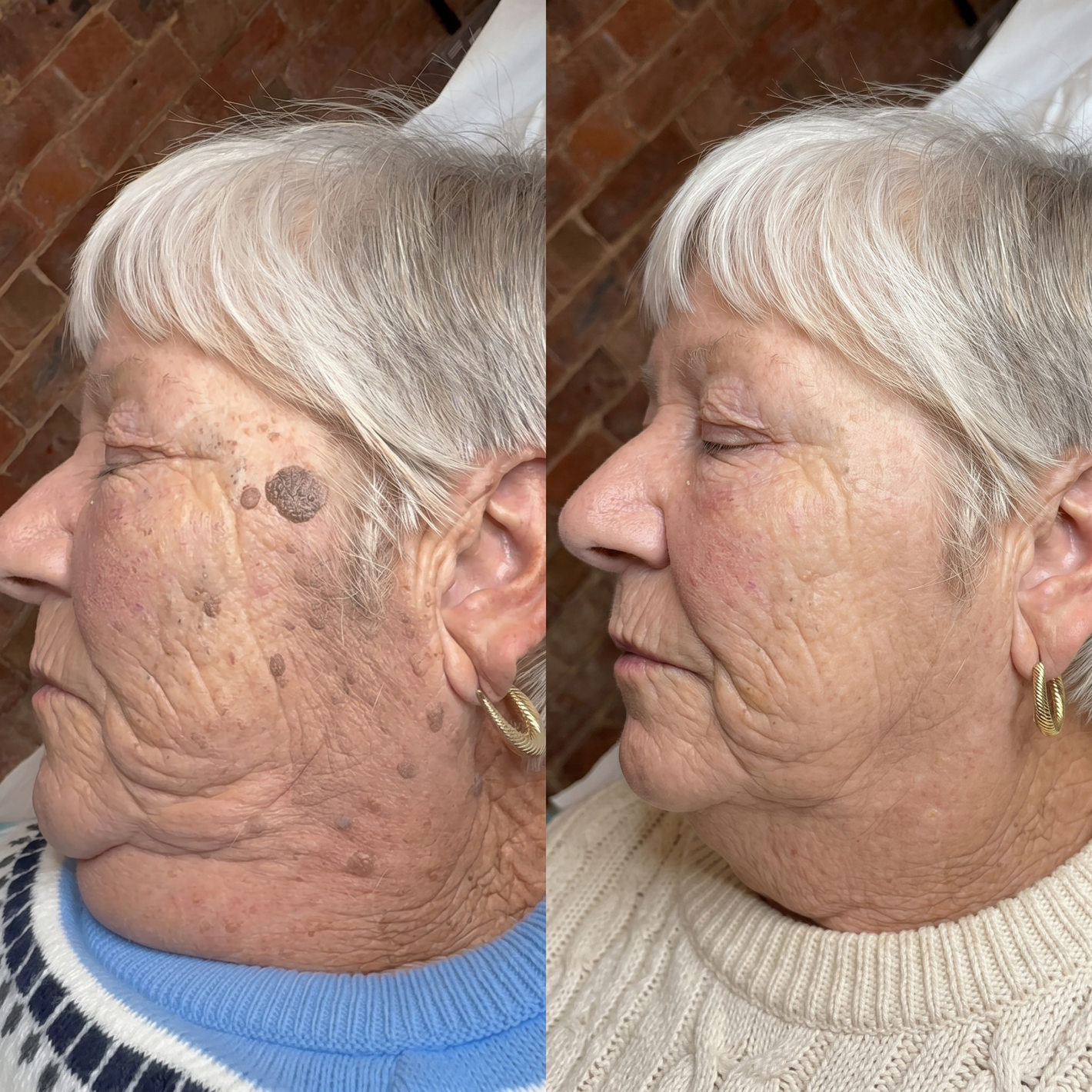 Customer story showing facial skin concerns